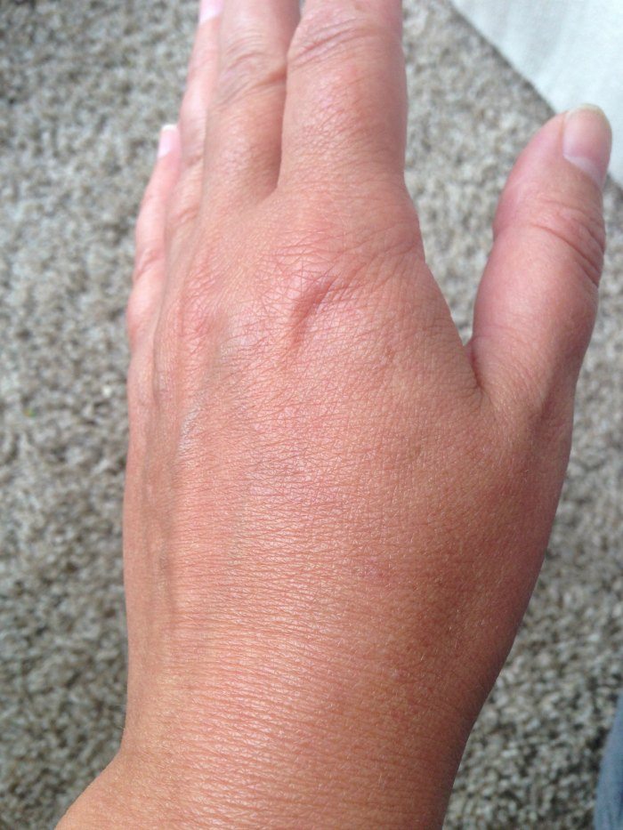 Hand closeup healthy skin after application of Ureadin Ultra10 Lotion Plus